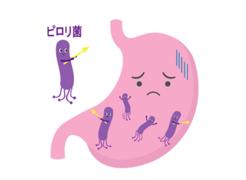 ピロリ菌検査を受けようと思っている方へ