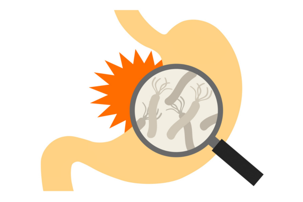 ピロリ菌を「除菌しない方がいい」と言われているのは本当？｜感染経路から除菌しないリスクまで詳しく解説